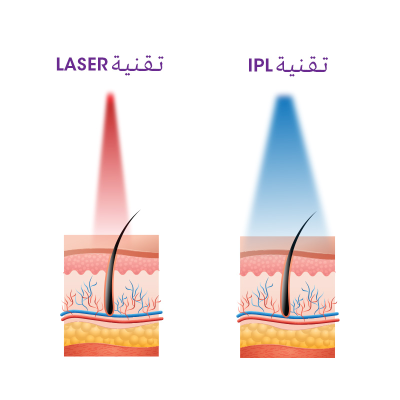 يعمل بتقنية IPL