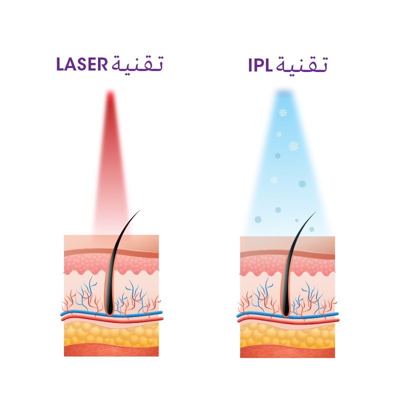 أحدث ما وصلت إليه تكنولوجيا IPL